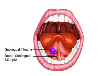 Sublingual